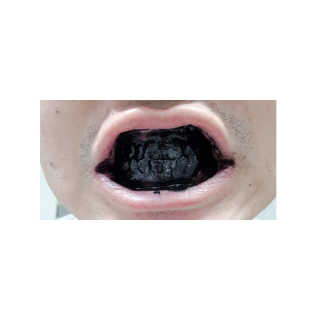 the naked object 디블랙팩치약 디블랙칫솔 세트 — 5점을 준 리뷰어가 2019년 3월 올린 사용 사진