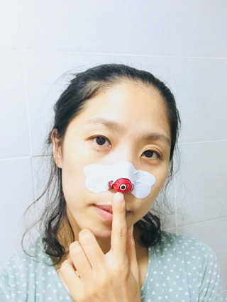 나이팅게일 TAKO PACK NOSE [문어코팩] — 5점을 준 리뷰어가 2018년 7월 올린 사용 사진