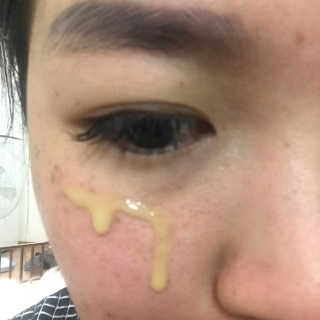보타니티 [홍]조[진]정[결]케어 플라본 세럼 — 3.83점을 준 리뷰어가 2018년 5월 올린 사용 사진