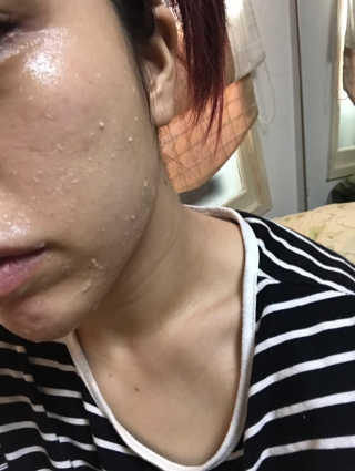 타임인네이처 [더메디닥터] 카렌듈라 엔자임 필링젤 — 5점을 준 리뷰어가 2019년 4월 올린 사용 사진