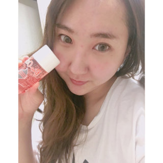 Bio-oil(바이오오일) 바이오오일(Bio-oil) — 3점을 준 리뷰어가 2016년 8월 올린 사용 사진