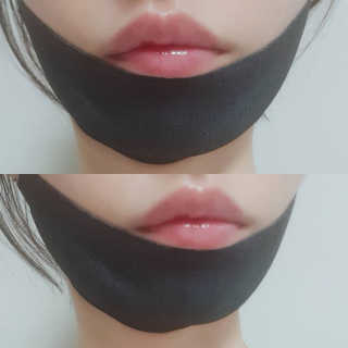 어웨이크어슬립 어슬립 페이스 리프트업 밴드 — 4.33점을 준 리뷰어가 2018년 6월 올린 사용 사진