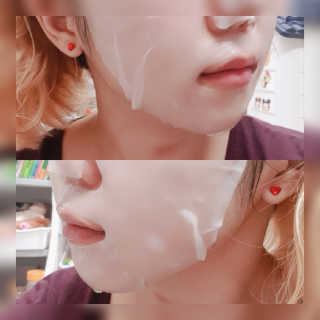 로벡틴 닥터 마스크 시카 — 4점을 준 리뷰어가 2020년 1월 올린 사용 사진