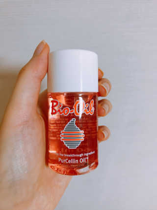 Bio-oil(바이오오일) 바이오오일(Bio-oil) — 4점을 준 리뷰어가 2017년 1월 올린 사용 사진