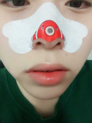 나이팅게일 TAKO PACK NOSE [문어코팩] — 4.5점을 준 리뷰어가 2017년 4월 올린 사용 사진