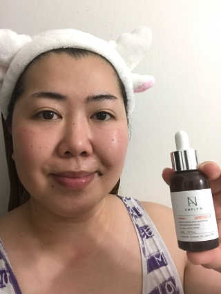 앰플엔 AMPLEN VC SHOT AMPOULE — 5점을 준 리뷰어가 2018년 12월 올린 사용 사진