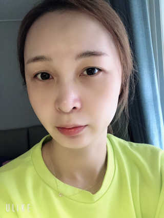 닥터헤디슨 헤디슨 퍼펙트 썬블럭 — 5점을 준 리뷰어가 2019년 9월 올린 사용 사진