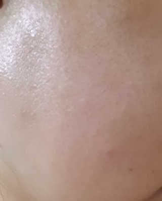 쏘내추럴 레드 필 팅글 세럼 오리지널 — 4점을 준 리뷰어가 2019년 8월 올린 사용 사진