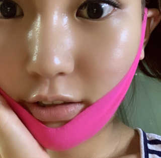스케덤 펩타이드 리프팅밴드 — 5점을 준 리뷰어가 2019년 5월 올린 사용 사진