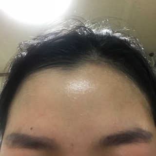 보타니티 [홍]조[진]정[결]케어 플라본 세럼 — 3.83점을 준 리뷰어가 2018년 5월 올린 사용 사진