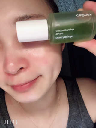 셀리맥스 노니 에너지 앰플 — 5점을 준 리뷰어가 2019년 8월 올린 사용 사진