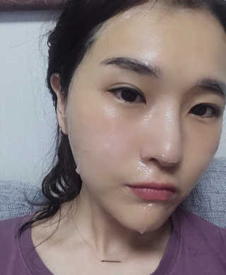 메디타임 멜라반 더마 토닝 씬젤 — 5점을 준 리뷰어가 2019년 5월 올린 사용 사진
