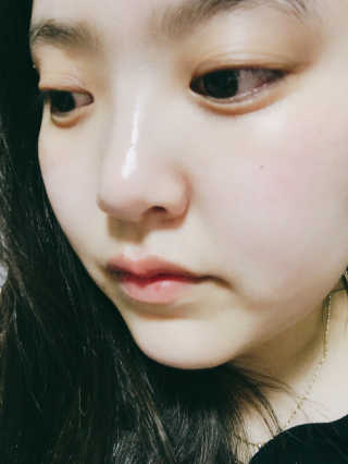 나이팅게일 티타민 크림 리뉴얼 — 5점을 준 리뷰어가 2018년 4월 올린 사용 사진