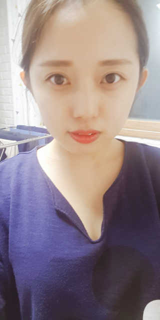 벤튼 티트리 클렌징 워터 — 4점을 준 리뷰어가 2018년 3월 올린 사용 사진