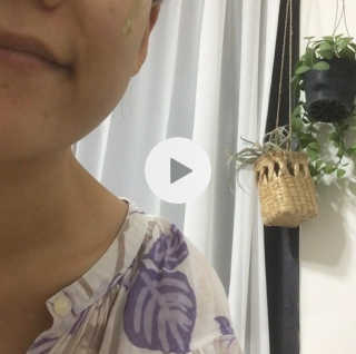 셀리맥스 노니 에너지 앰플 — 4점을 준 리뷰어가 2019년 8월 올린 사용 사진