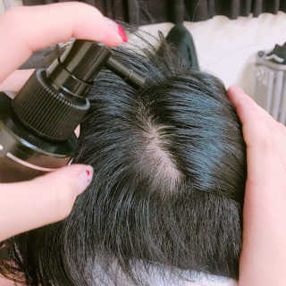 다슈코리아 다슈 안티 헤어로스 허브 헤어토닉 — 3.67점을 준 리뷰어가 2017년 6월 올린 사용 사진