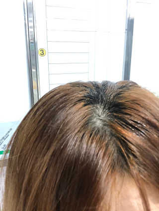 달리프 클로렐라 베러 루트 쿨링 스프레이 100ml — 5점을 준 리뷰어가 2019년 7월 올린 사용 사진