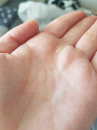 [스킨큐어] 산다화 비타민C 화이트닝 에센스 30ml — 5점을 준 리뷰어가 2019년 7월 올린 사용 사진