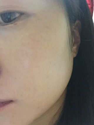브에노 재생비비크림 — 3.83점을 준 리뷰어가 2017년 11월 올린 사용 사진