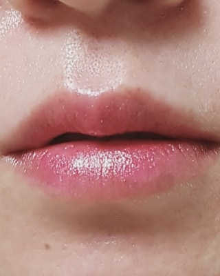 블리스텍스 립 릴리프 크림 립밤, 립 바이브런스 립밤 — 5점을 준 리뷰어가 2018년 11월 올린 사용 사진