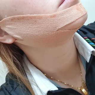 아이디플라코스메틱 아이디 페이스핏 마이너스 밴드 — 4점을 준 리뷰어가 2019년 11월 올린 사용 사진