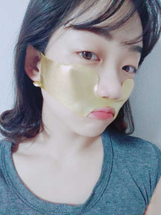 [스케덤] 상악밴드 — 4점을 준 리뷰어가 2019년 7월 올린 사용 사진