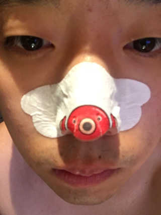 나이팅게일 TAKO PACK NOSE [문어코팩] — 1.83점을 준 리뷰어가 2017년 5월 올린 사용 사진