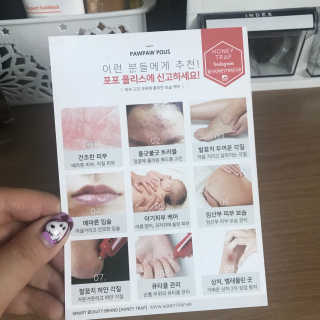 Honey Trap 포포폴리스 멀티밤 — 5점을 준 리뷰어가 2018년 3월 올린 사용 사진