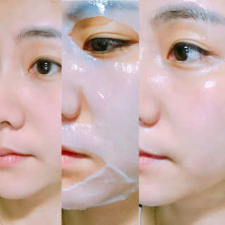 에슬레나 엑스트라 밸런싱 힐링 마스크 10장 — 4.33점을 준 리뷰어가 2017년 11월 올린 사용 사진
