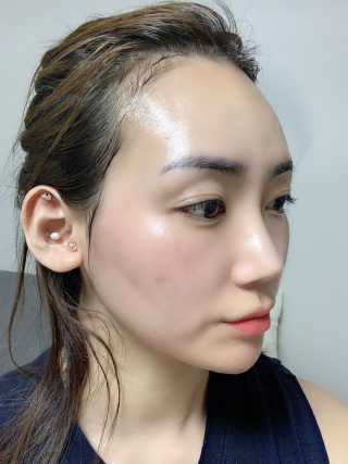 씨엘포 맥스 히아루로닉 프로폴리스 앰플 — 5점을 준 리뷰어가 2019년 5월 올린 사용 사진