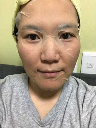 보타메디 씨놀®미라클마스크팩 — 4점을 준 리뷰어가 2019년 1월 올린 사용 사진