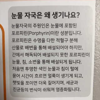 잠보아 뉴트리페어 굿바이 티어스테인 — 5점을 준 리뷰어가 2019년 8월 올린 사용 사진