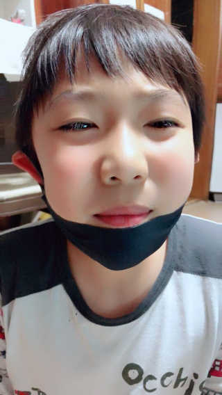 어웨이크어슬립 어슬립 페이스 리프트업 밴드 — 4.17점을 준 리뷰어가 2018년 6월 올린 사용 사진
