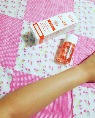 Bio-oil(바이오오일) 바이오오일(Bio-oil) — 3.5점을 준 리뷰어가 2016년 8월 올린 사용 사진