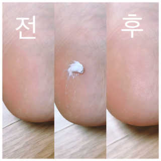 (주)에네스티 에네스티 수안수 실크스킨 풋크림 1+1 — 4점을 준 리뷰어가 2019년 12월 올린 사용 사진