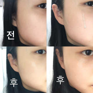 헤이톡 블루 아줄렌 오일세럼 — 4점을 준 리뷰어가 2020년 1월 올린 사용 사진