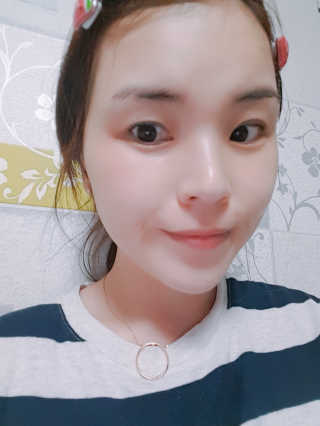 아쿠아큐링 아쿠아덤 바이오셀룰로오스 페이스앤넥 마스크팩 10매 — 5점을 준 리뷰어가 2018년 9월 올린 사용 사진