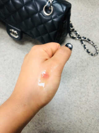 [트리앤씨] 시그니처 리프레쉬 타마누오일 30ml — 4점을 준 리뷰어가 2019년 3월 올린 사용 사진