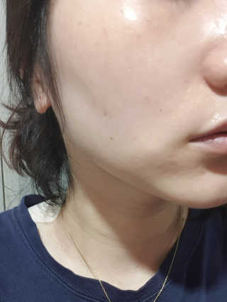 타임인네이처 [더메디닥터] 카렌듈라 엔자임 필링젤 — 4점을 준 리뷰어가 2019년 3월 올린 사용 사진