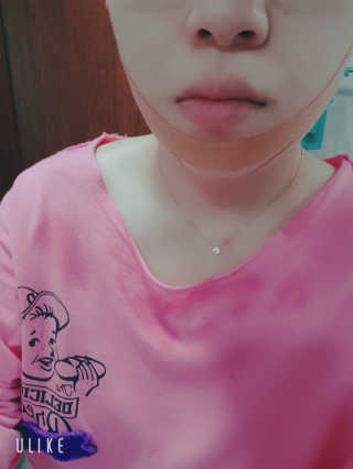 아이디플라코스메틱 아이디 페이스핏 마이너스 밴드 — 5점을 준 리뷰어가 2020년 3월 올린 사용 사진