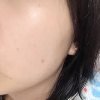 AHC 에이 에이치 씨 미니멀 10 워터리 에센스 — 4점을 준 리뷰어가 2018년 12월 올린 사용 사진