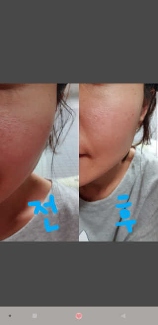 파시스 펩타이드 리프팅 크림 — 5점을 준 리뷰어가 2018년 11월 올린 사용 사진