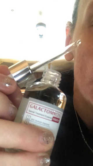 [마녀 공장] 발가락 토미 니아신 에센스 50ml — 5점을 준 리뷰어가 2018년 11월 올린 사용 사진