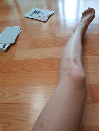 레티지아 수퍼스림 압박스타킹 20D + 22D 세트 — 4.67점을 준 리뷰어가 2018년 5월 올린 사용 사진