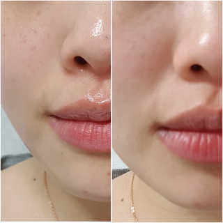 야시엔코 앰플수면팩 퍼플 — 5점을 준 리뷰어가 2019년 2월 올린 사용 사진