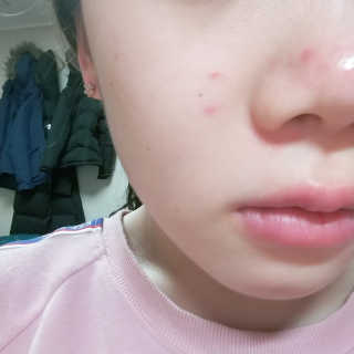 보타니티 [홍]조[진]정[결]케어 플라본 세럼 — 5점을 준 리뷰어가 2018년 5월 올린 사용 사진