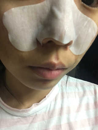 나이팅게일 TAKO PACK NOSE [문어코팩] — 2.17점을 준 리뷰어가 2017년 6월 올린 사용 사진