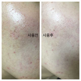 김리하님이 올린 리뷰 사진 2