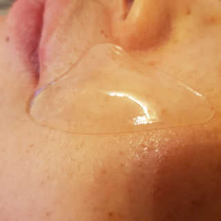 아이디플라코스메틱 아이디 페이스핏 플러스 패치 — 5점을 준 리뷰어가 2019년 10월 올린 사용 사진