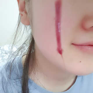 쏘내추럴 레드 필 팅글 세럼 오리지널 — 5점을 준 리뷰어가 2019년 8월 올린 사용 사진
